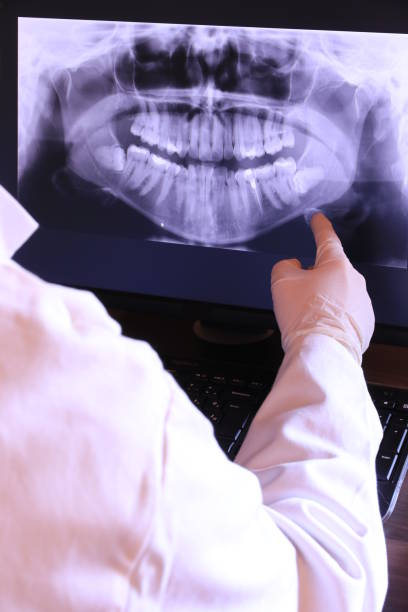 Best Emergency Denture Repair in Lake Hopatcong, NJ